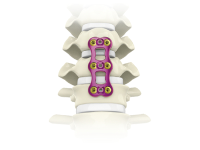 CanACE頸椎前路釘板系統