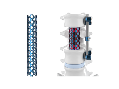 CanMESH椎體融合器（鈦網）