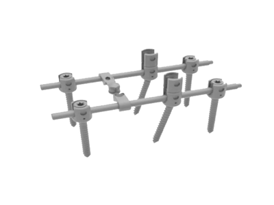 CanART胸腰椎后路內固定系統